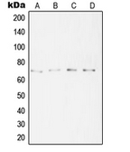 Anti-SYT16 antibody used in Western Blot (WB). GTX55975