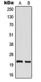 Anti-TM2D1 antibody used in Western Blot (WB). GTX55976