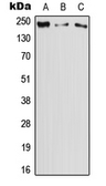 Anti-DOCK11 antibody used in Western Blot (WB). GTX55982