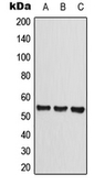 Anti-CLEC14A antibody used in Western Blot (WB). GTX55986