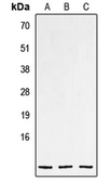 Anti-CNP antibody used in Western Blot (WB). GTX55996