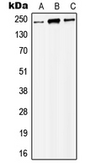Anti-MORF antibody used in Western Blot (WB). GTX56004