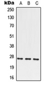 Anti-PRRX2 antibody used in Western Blot (WB). GTX56006