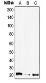 Anti-CIB4 antibody used in Western Blot (WB). GTX56020
