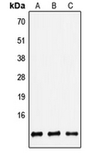 Anti-beta 2 Defensin antibody used in Western Blot (WB). GTX56023