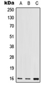 Anti-RPS17 antibody used in Western Blot (WB). GTX56024