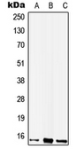 Anti-WIT1 antibody used in Western Blot (WB). GTX56025
