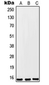 Anti-TPT1P8 antibody used in Western Blot (WB). GTX56026