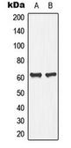 Anti-PLA2G4C antibody used in Western Blot (WB). GTX56033
