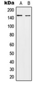 Anti-NEDL2 antibody used in Western Blot (WB). GTX56038