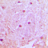 Anti-UBTD1 antibody used in IHC (Paraffin sections) (IHC-P). GTX56040