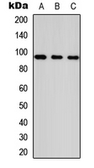 Anti-ANKRD20A1 antibody used in Western Blot (WB). GTX56043