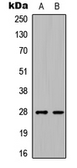 Anti-C1QL3 antibody used in Western Blot (WB). GTX56048