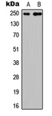 Anti-CAIN antibody used in Western Blot (WB). GTX56049
