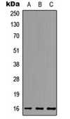 Anti-MCFD2 antibody used in Western Blot (WB). GTX56060