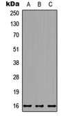 Anti-NDUFB7 antibody used in Western Blot (WB). GTX56063