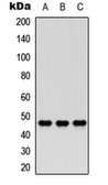 Anti-Nocturnin antibody used in Western Blot (WB). GTX56065