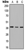 Anti-RTDR1 antibody used in Western Blot (WB). GTX56072
