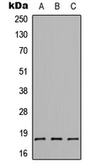 Anti-CMTM1 antibody used in Western Blot (WB). GTX56089