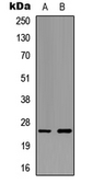 Anti-Ephrin A5 antibody used in Western Blot (WB). GTX56095