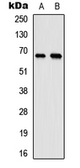Anti-ELL antibody used in Western Blot (WB). GTX56096