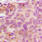 Anti-NDUFA3 antibody used in IHC (Paraffin sections) (IHC-P). GTX56108