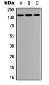 Anti-PTPD1 antibody used in Western Blot (WB). GTX56114