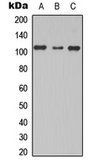 Anti-TBC1D2 antibody used in Western Blot (WB). GTX56123