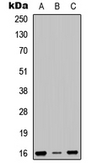 Anti-RPS23 antibody used in Western Blot (WB). GTX56138
