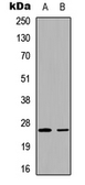 Anti-UBTD2 antibody used in Western Blot (WB). GTX56139