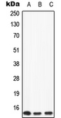 Anti-Apolipoprotein CII antibody used in Western Blot (WB). GTX56149