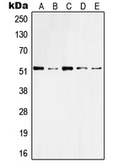 Anti-Cytokeratin 10 antibody used in Western Blot (WB). GTX56159