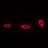 Anti-NDUFA4 antibody used in Immunocytochemistry/ Immunofluorescence (ICC/IF). GTX56160
