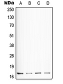Anti-Somatostatin antibody used in Western Blot (WB). GTX56172