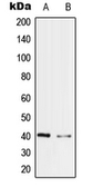 Anti-PRP18 antibody used in Western Blot (WB). GTX56179