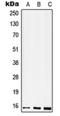 Anti-CD52 antibody used in Western Blot (WB). GTX56193
