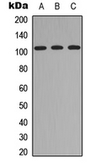 Anti-ITIH4 antibody used in Western Blot (WB). GTX56210