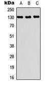Anti-PRDM10 antibody used in Western Blot (WB). GTX56214