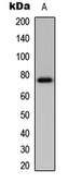 Anti-BMX antibody used in Western Blot (WB). GTX56219