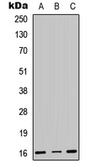 Anti-CENPA antibody used in Western Blot (WB). GTX56223