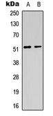 Anti-mAChR M1 antibody used in Western Blot (WB). GTX56224