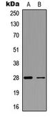 Anti-FGF23 antibody used in Western Blot (WB). GTX56227