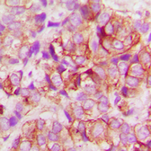 Anti-Bax antibody used in IHC (Paraffin sections) (IHC-P). GTX56246