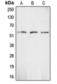 Anti-Chk1 antibody used in Western Blot (WB). GTX56248