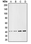 Anti-CMKLR1 antibody used in Western Blot (WB). GTX56249