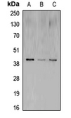 Anti-CREB antibody used in Western Blot (WB). GTX56252