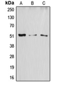 Anti-ATF2 antibody used in Western Blot (WB). GTX56254