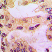 Anti-Cathepsin D antibody used in IHC (Paraffin sections) (IHC-P). GTX56269