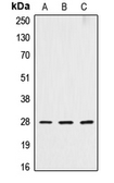 Anti-Cathepsin D Heavy chain antibody used in Western Blot (WB). GTX56270
