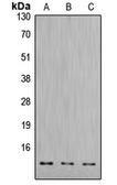 Anti-Cathepsin D Light chain antibody used in Western Blot (WB). GTX56271